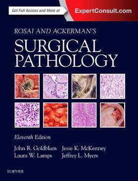 Goldblum / Lamps / McKenney |  Rosai and Ackerman's Surgical Pathology - 2 Volume Set | Buch |  Sack Fachmedien