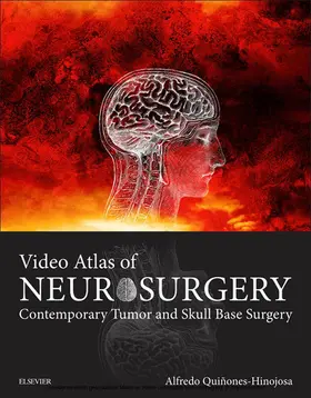 Quinones-Hinojosa MD / Quinones-Hinojosa |  Video Atlas of Neurosurgery E-Book | eBook | Sack Fachmedien