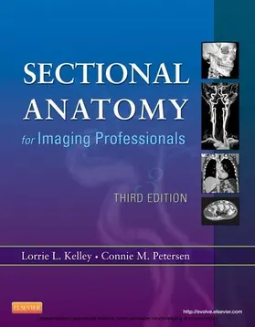 Kelley / Petersen |  Sectional Anatomy for Imaging Professionals - E-Book | eBook | Sack Fachmedien