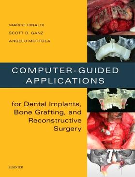 Rinaldi / Ganz / Mottola |  Computer-Guided Applications for Dental Implants, Bone Grafting, and Reconstructive Surgery (Adapted Translation) | Buch |  Sack Fachmedien