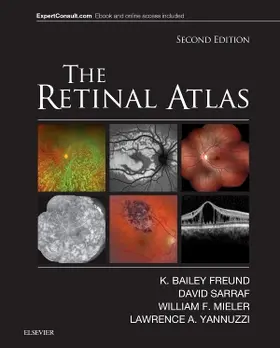 Freund / Mieler / Sarraf |  The Retinal Atlas | Buch |  Sack Fachmedien