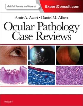 Azari / Albert |  Ocular Pathology Case Reviews: Expert Consult - Online and Print | Buch |  Sack Fachmedien