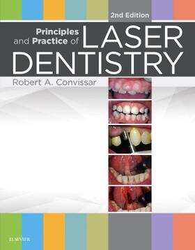 Convissar | Principles and Practice of Laser Dentistry | Buch | 978-0-323-29762-2 | sack.de