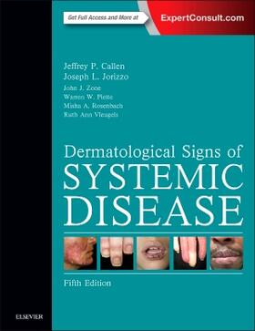 Callen / Jorizzo / Zone |  Dermatological Signs of Systemic Disease | Buch |  Sack Fachmedien