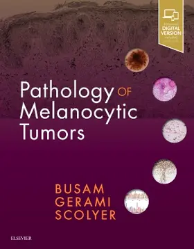 Busam / Gerami / Scolyer |  Pathology of Melanocytic Tumors | Buch |  Sack Fachmedien