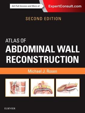 Rosen |  Atlas of Abdominal Wall Reconstruction | Buch |  Sack Fachmedien