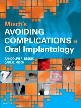 Misch / Resnik |  Misch's Avoiding Complications in Oral Implantology | Buch |  Sack Fachmedien