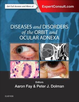 Fay / Dolman |  Diseases and Disorders of the Orbit and Ocular Adnexa | Buch |  Sack Fachmedien