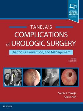 Taneja / Shah |  Complications of Urologic Surgery | Buch |  Sack Fachmedien