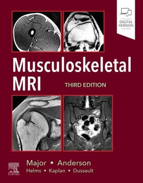 Major / Anderson |  Musculoskeletal MRI | Buch |  Sack Fachmedien