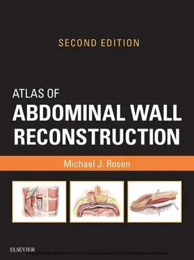 Rosen |  Atlas of Abdominal Wall Reconstruction E-Book | eBook | Sack Fachmedien