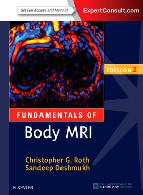 Roth / Deshmukh |  Fundamentals of Body MRI | Buch |  Sack Fachmedien