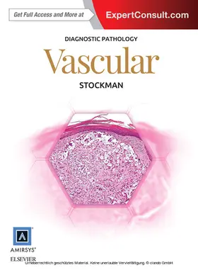 Stockman MD |  Diagnostic Pathology: Vascular E-Book | eBook | Sack Fachmedien