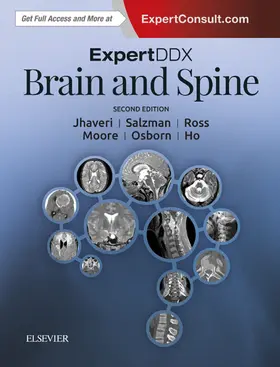 Salzman / Jhaveri / Ross |  ExpertDDx: Brain and Spine E-Book | eBook | Sack Fachmedien