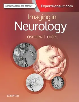 Osborn / Digre |  Imaging in Neurology | Buch |  Sack Fachmedien