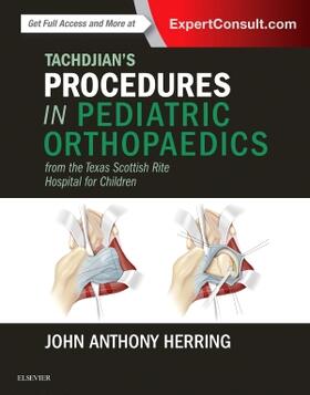 Herring |  Tachdjian's Procedures in Pediatric Orthopaedics | Buch |  Sack Fachmedien