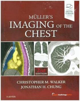 Walker / Chung |  Muller's Imaging of the Chest | Buch |  Sack Fachmedien