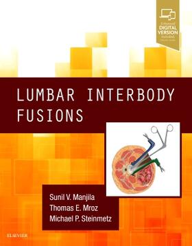 Manjila / Mroz / Steinmetz |  Lumbar Interbody Fusions | Buch |  Sack Fachmedien