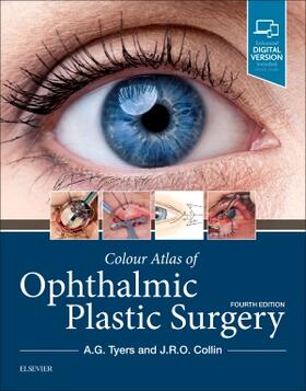 Tyers / Collin |  Colour Atlas of Ophthalmic Plastic Surgery | Buch |  Sack Fachmedien