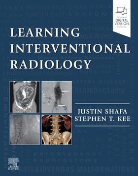 Shafa / Kee |  Learning Interventional Radiology | Buch |  Sack Fachmedien