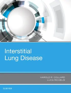 Collard / Richeldi |  Interstitial Lung Disease | Buch |  Sack Fachmedien