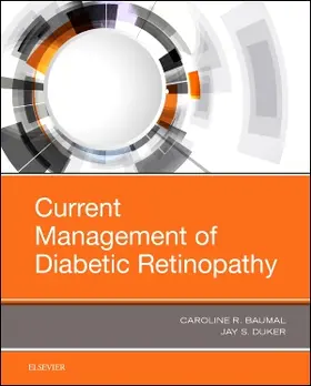 Baumal / Duker |  Current Management of Diabetic Retinopathy | Buch |  Sack Fachmedien