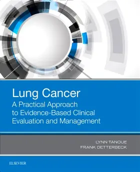 Tanoue / Detterbeck |  Lung Cancer: A Practical Approach to Evidence-Based Clinical Evaluation and Management | Buch |  Sack Fachmedien