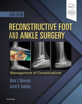Myerson / Kadakia |  Reconstructive Foot and Ankle Surgery: Management of Complications | Buch |  Sack Fachmedien