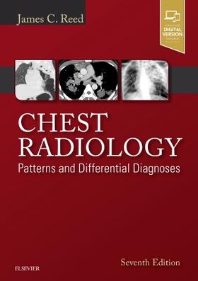 Reed |  Chest Radiology | Buch |  Sack Fachmedien