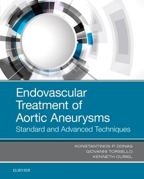 Donas / Torsello / Ouriel |  Endovascular Treatment of Aortic Aneurysms | Buch |  Sack Fachmedien