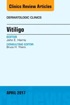 Harris |  Vitiligo, an Issue of Dermatologic Clinics | Buch |  Sack Fachmedien