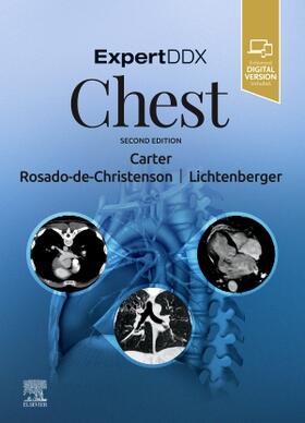 Carter / Rosado-de-Christenson / Lichtenberger III |  Expertddx: Chest | Buch |  Sack Fachmedien