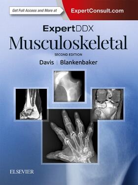 Davis / Blankenbaker |  Expertddx: Musculoskeletal | Buch |  Sack Fachmedien