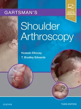 Elkousy / Edwards |  Gartsman's Shoulder Arthroscopy | Buch |  Sack Fachmedien