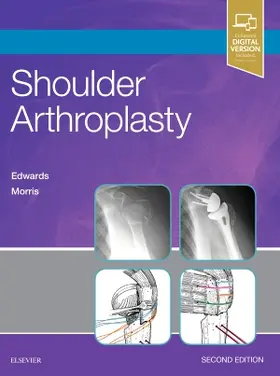 Edwards / Morris |  Shoulder Arthroplasty | Buch |  Sack Fachmedien