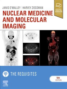 O'Malley / Ziessman |  Nuclear Medicine and Molecular Imaging: The Requisites | Buch |  Sack Fachmedien