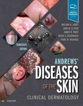 Elston / James / Treat |  Andrews' Diseases of the Skin | Buch |  Sack Fachmedien