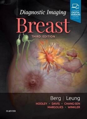 Berg / Leung |  Diagnostic Imaging: Breast | Buch |  Sack Fachmedien