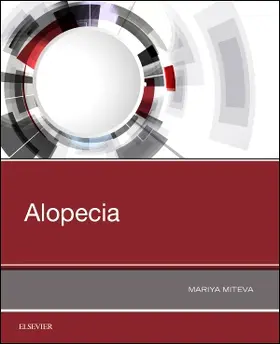 Miteva |  Alopecia | Buch |  Sack Fachmedien