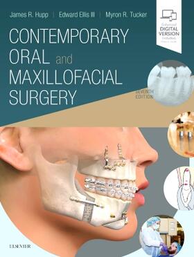 Ellis / Hupp / Tucker |  Contemporary Oral and Maxillofacial Surgery | Buch |  Sack Fachmedien