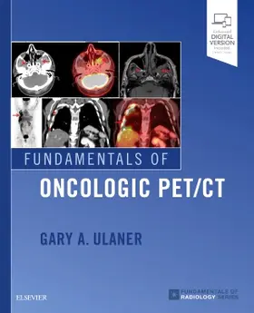 Ulaner |  Fundamentals of Oncologic Pet/CT | Buch |  Sack Fachmedien