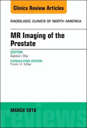 Oto |  MR Imaging of the Prostate, an Issue of Radiologic Clinics of North America | Buch |  Sack Fachmedien