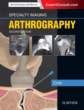 Crim |  Specialty Imaging: Arthrography | Buch |  Sack Fachmedien