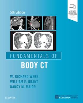 Major / Webb / Brant |  Fundamentals of Body CT | Buch |  Sack Fachmedien