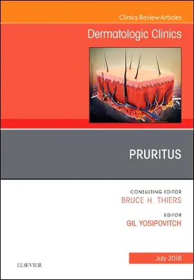 Yosipovitch |  Pruritus, an Issue of Dermatologic Clinics | Buch |  Sack Fachmedien