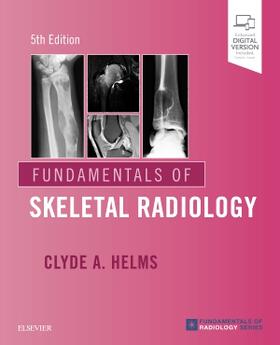 Helms |  Fundamentals of Skeletal Radiology | Buch |  Sack Fachmedien