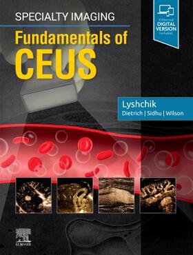 Lyshchik |  Specialty Imaging: Fundamentals of CEUS | Buch |  Sack Fachmedien