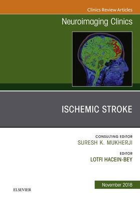 Hacein-Bey |  Ischemic Stroke, An Issue of Neuroimaging Clinics of North America E-Book | eBook | Sack Fachmedien