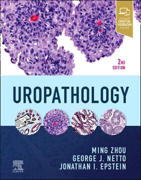 Netto / Zhou / Epstein |  Uropathology | Buch |  Sack Fachmedien