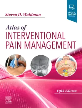 Waldman |  Atlas of Interventional Pain Management | Buch |  Sack Fachmedien